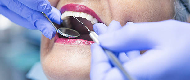 Best Emergency Gum Treatment in Zeigler, IL