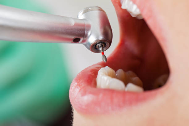 Best Weekend Emergency Dentist in Zeigler, IL